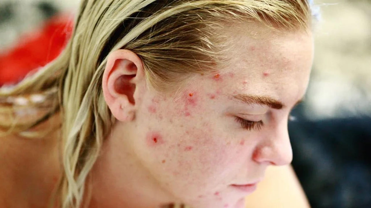 healthy skin