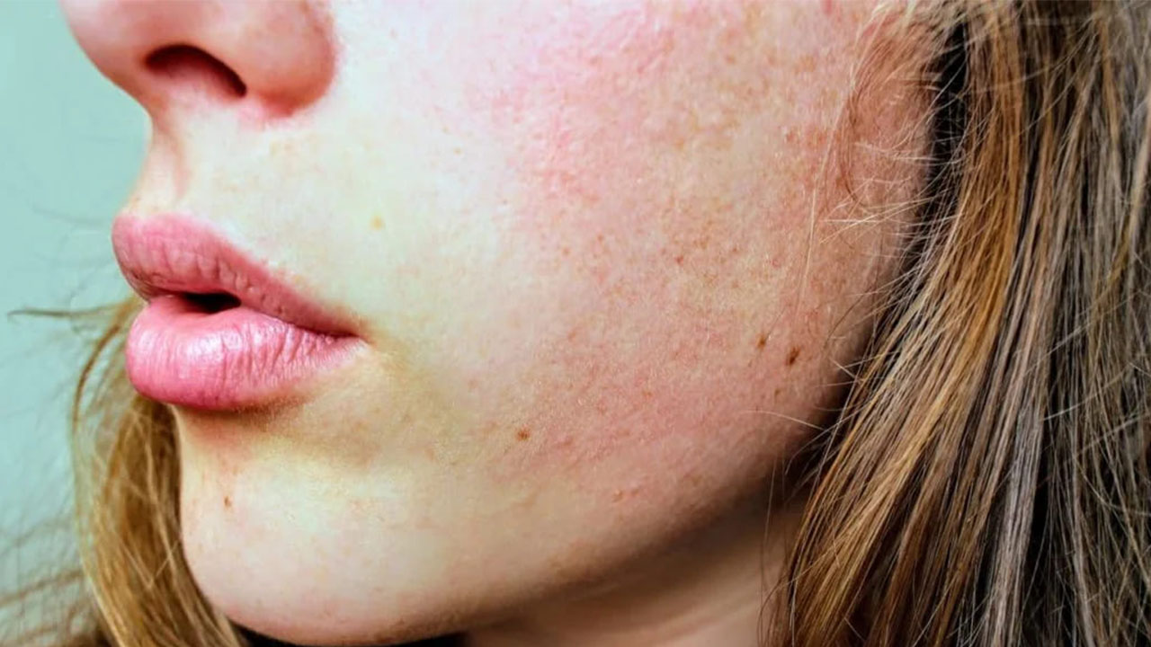 healthy skin