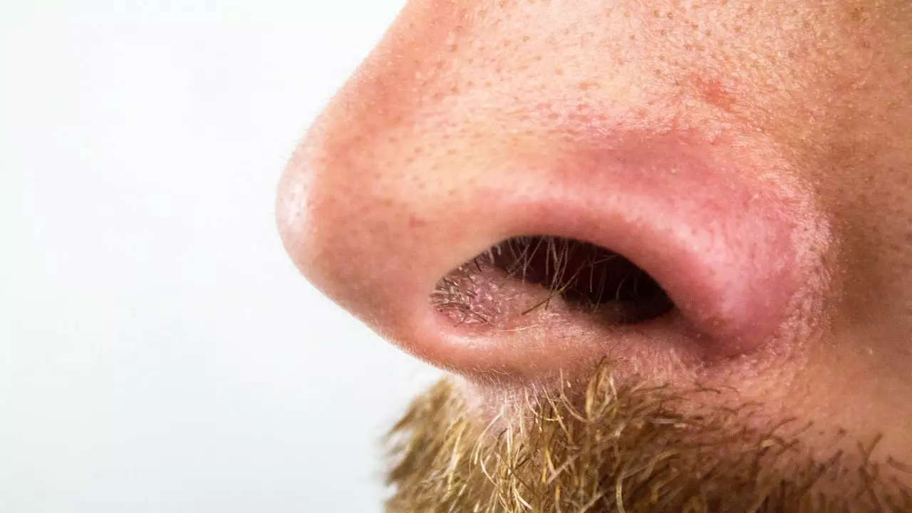 nose hair plucking infection