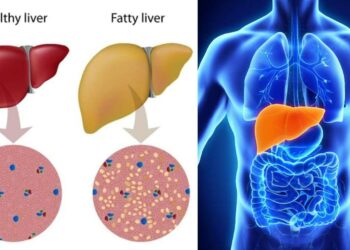 Liver Health