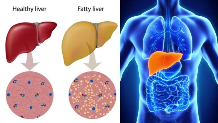 Liver Health