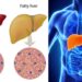 Liver Health