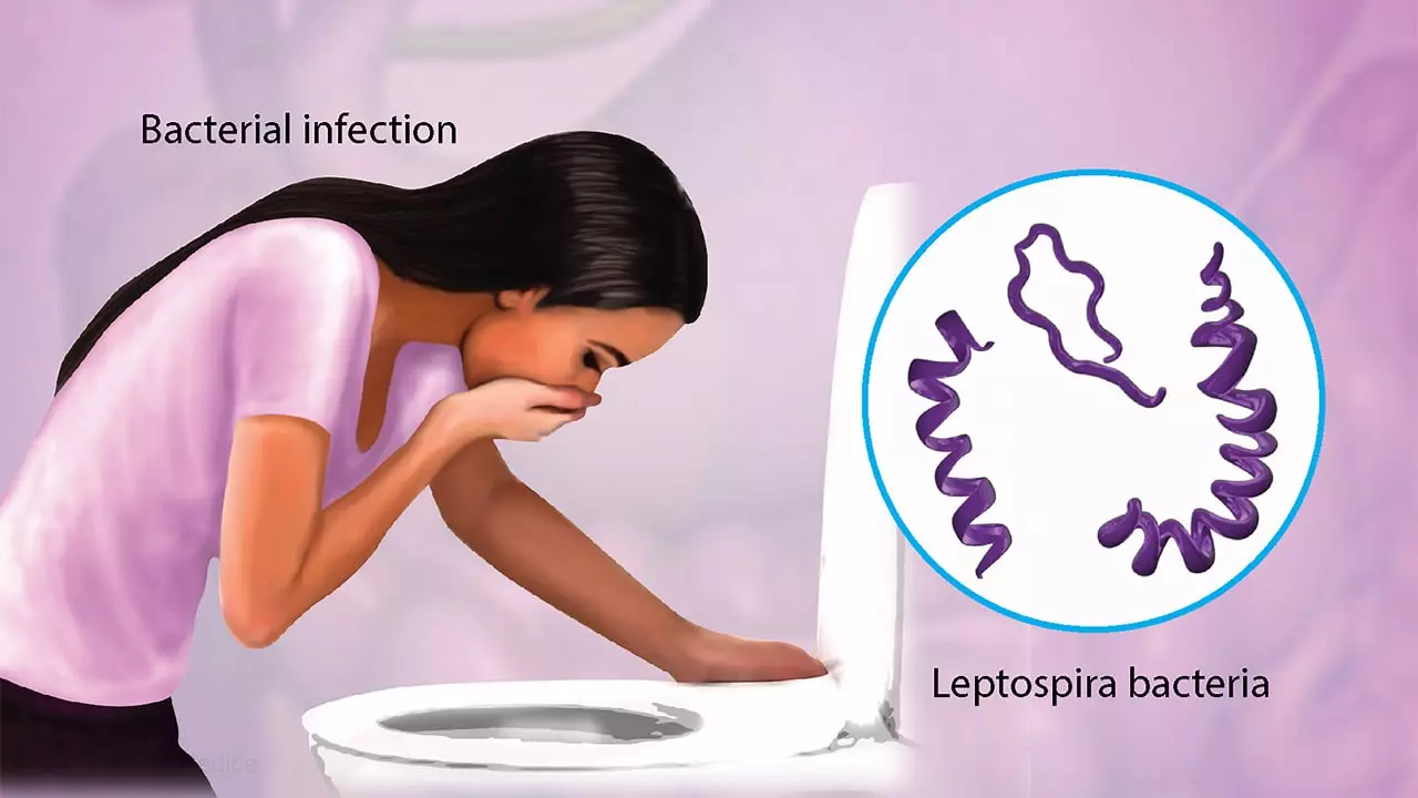 Leptospirosis