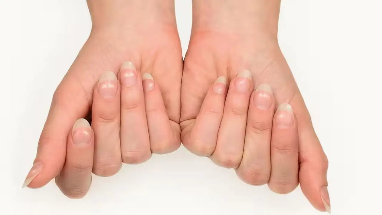 Illustration debunking myths about white spots on nails.