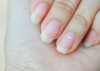 White Spots on Nails