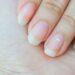 White Spots on Nails