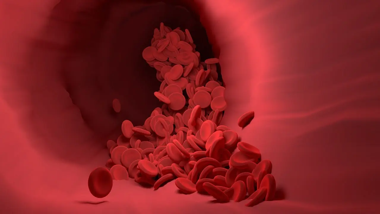 What Causes Blood Clots?