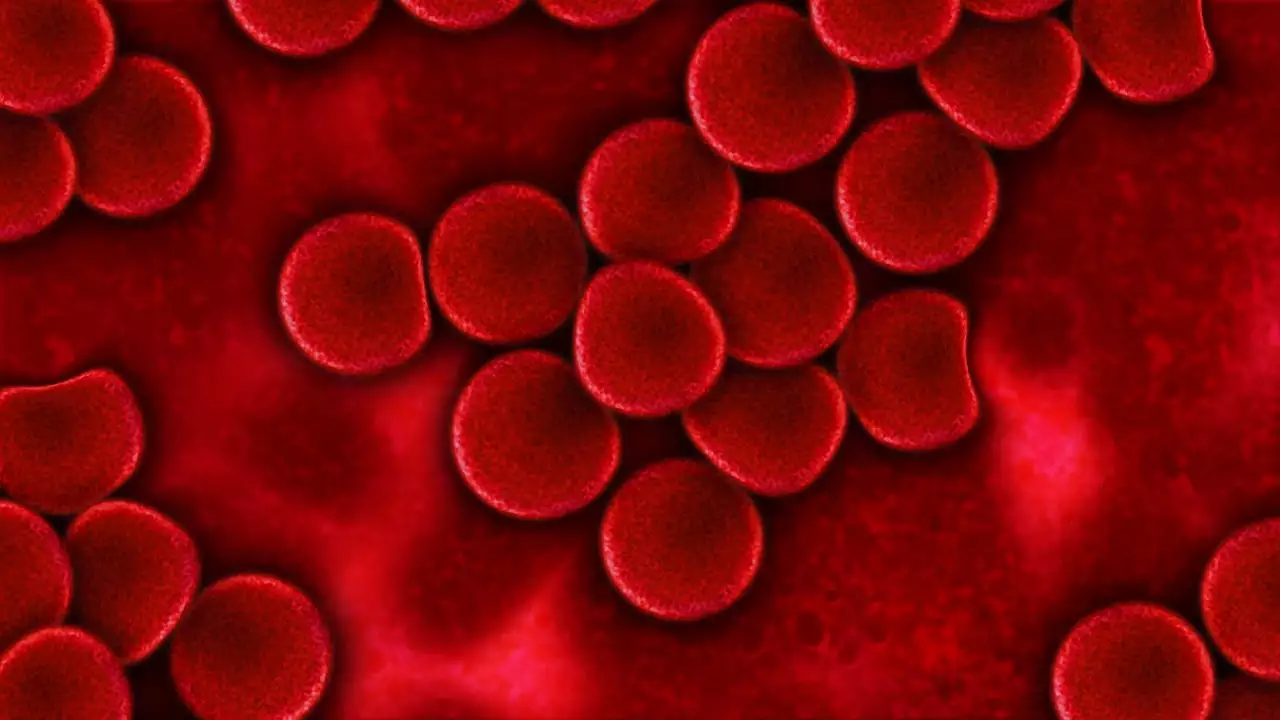 top ways to prevent blood clots?