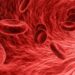 Blood Clot Risks