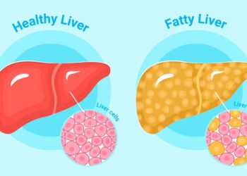Ayurvedic Home Remedies for Fatty Liver