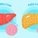 Ayurvedic Home Remedies for Fatty Liver