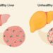 Fatty Liver Diet