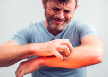 How to get rid of heat rash quickly