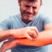 How to get rid of heat rash quickly