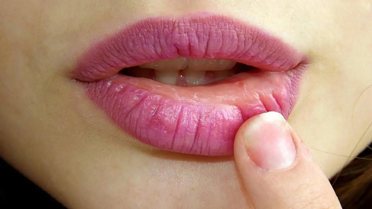 indian home remedies for chapped lips