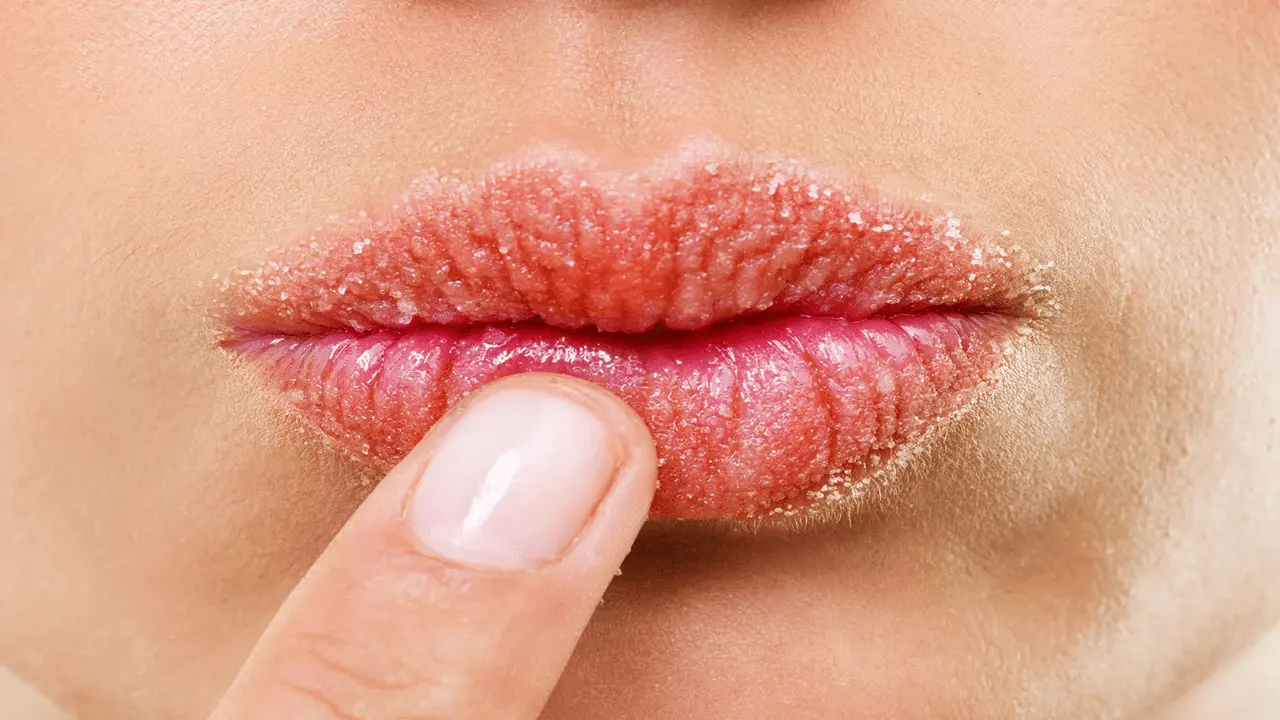 home remedies for chapped lips in the winter